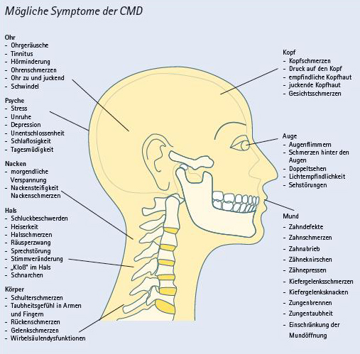 Was sind eigentlich CMD – craniomandibuläre Dysfunktionen?